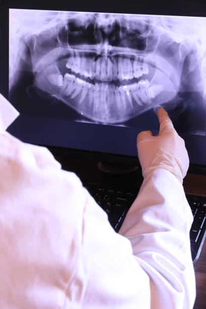 Best Emergency Root Canal Treatment in Morris, MN